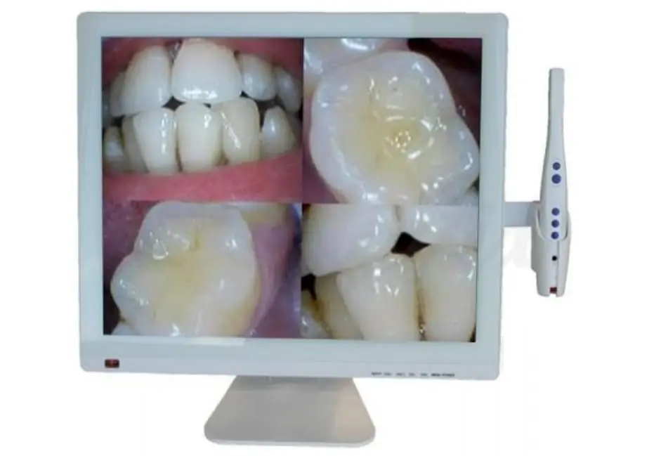 Cámara intraoral alta definición diagnóstico dental MOI Villa Urquiza