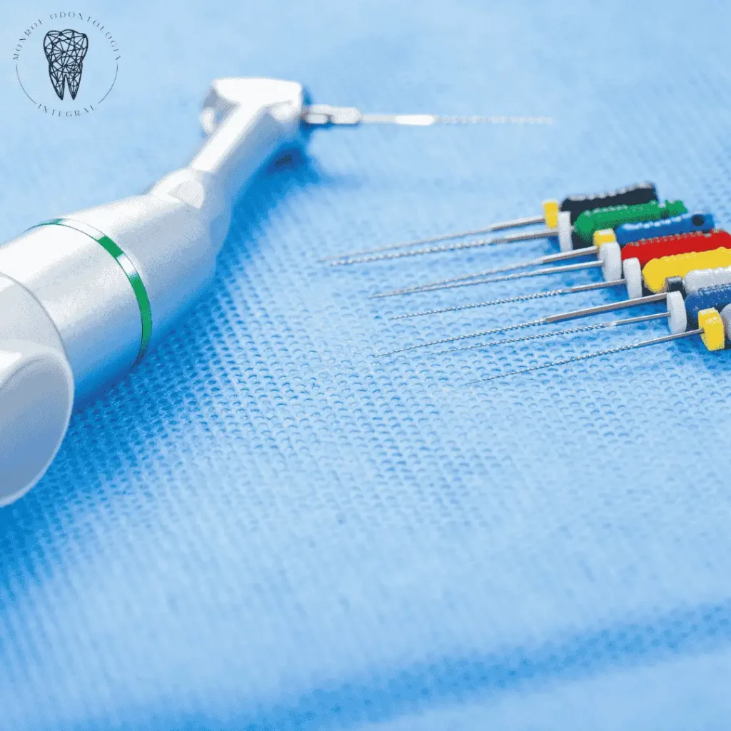 Tratamiento de endodoncia con tecnología mecanizada en Villa Urquiza