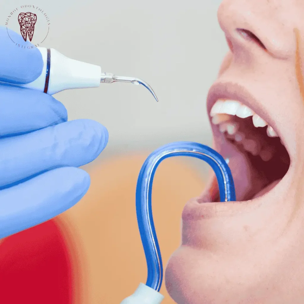 Limpieza dental profesional en clínica de Villa Urquiza CABA
