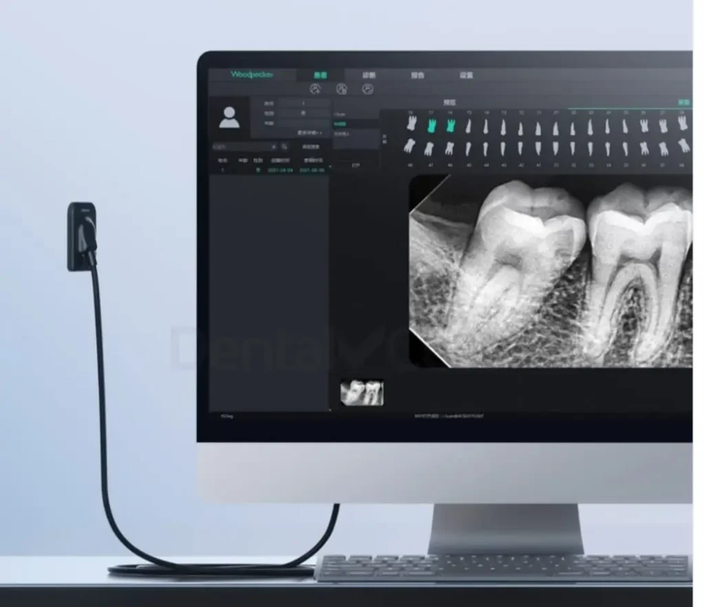 Radiovisiógrafo digital radiografía dental MOI Odontología Villa Urquiza