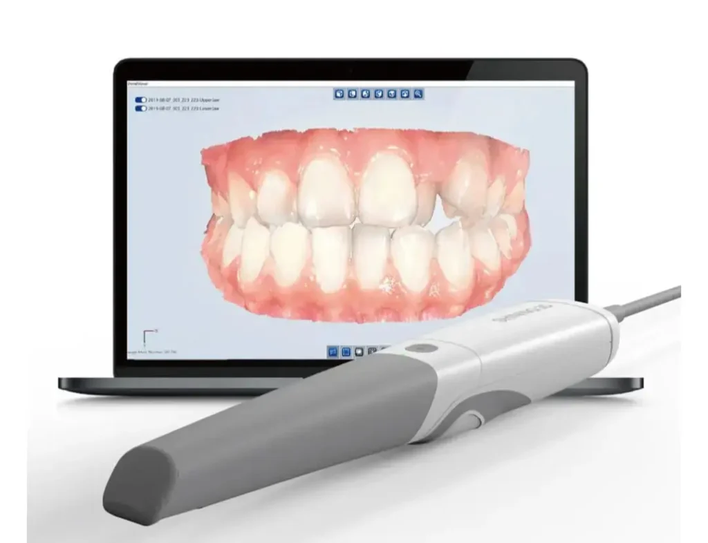 Escáner intraoral digital tecnología odontológica MOI Villa Urquiza