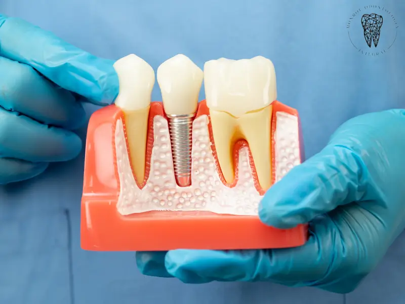 Implantes dentales en Villa Urquiza