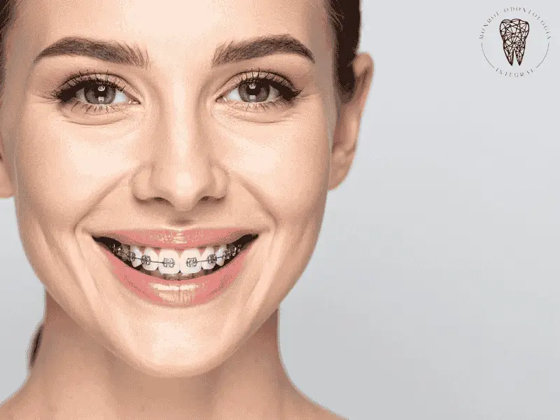 Ortodoncia en villa urquiza