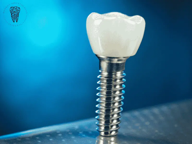 Implantes dentales Villa Urquiza garantizan calidad y efectividad. Monroe Odontología Integral ofrece seguridad y planes de pago flexibles.