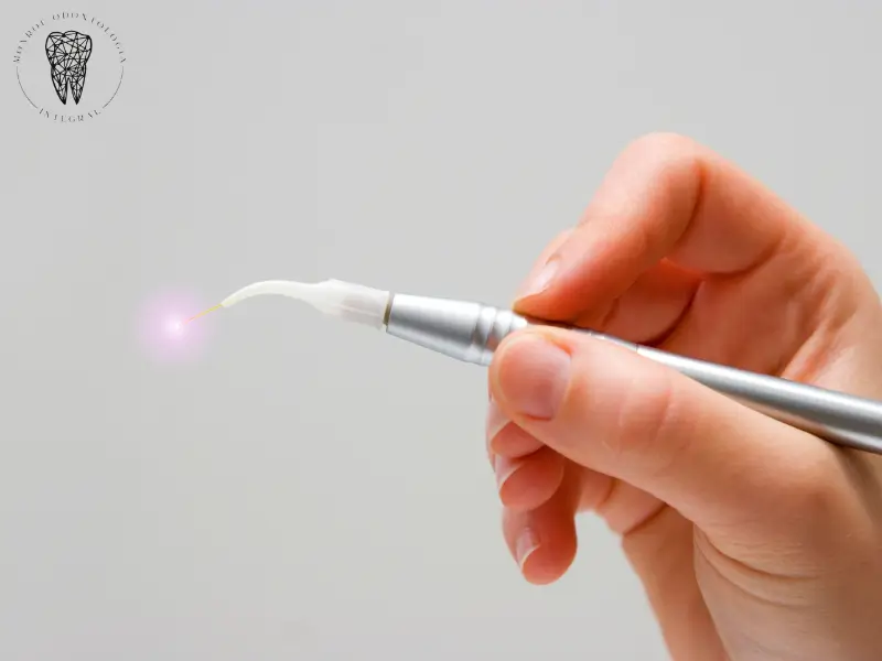 Odontología láser ofrece tratamientos dentales sin dolor y recuperación rápida. Conoce sus beneficios y aplicaciones en Monroe Odontología Integral.