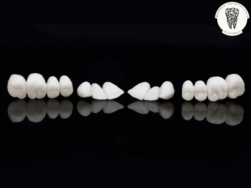 Dientes provisorios: ¿Estaré sin dientes en el tratamiento?